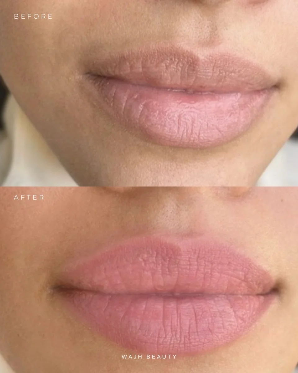Soft, natural lip blush result by WAJH Beauty